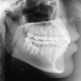 Radiologia Odontológica no Bonfiglioli